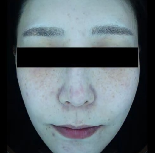 Before/After Image